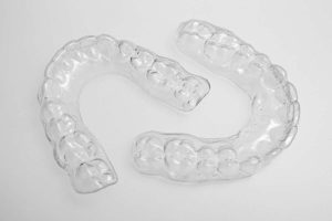 Essix Retainers
