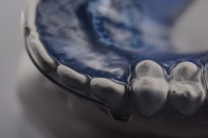 What are Hawley Retainers?